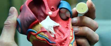 Xeltis: ‘levende’ hartkleppen van biologisch afbreekbare polymeren